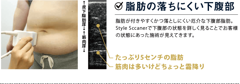 脂肪のい落ちにくい下腹部